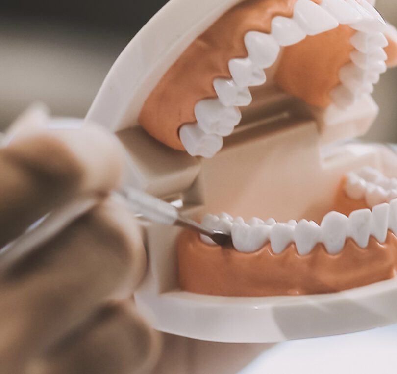 periodontal treatment cost