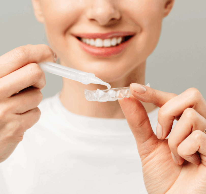 woman loading tooth whitening tray